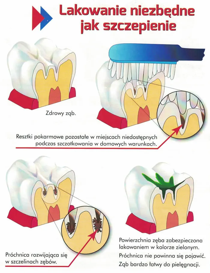 Profilaktyka stomatologiczna — zdjęcie 1