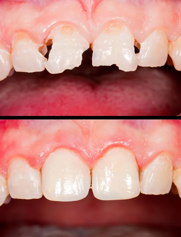 Stomatologia zachowawcza