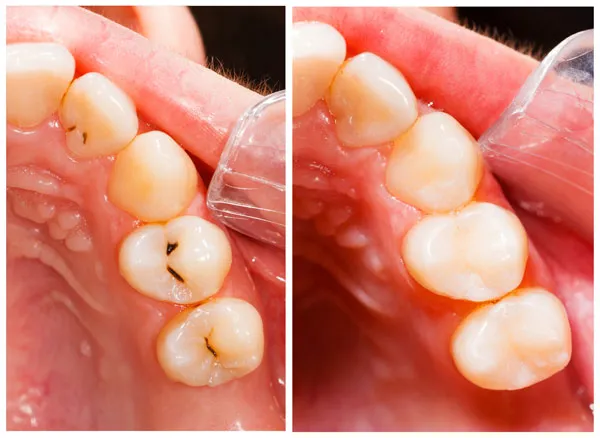 Stomatologia zachowawcza — zdjęcie 1