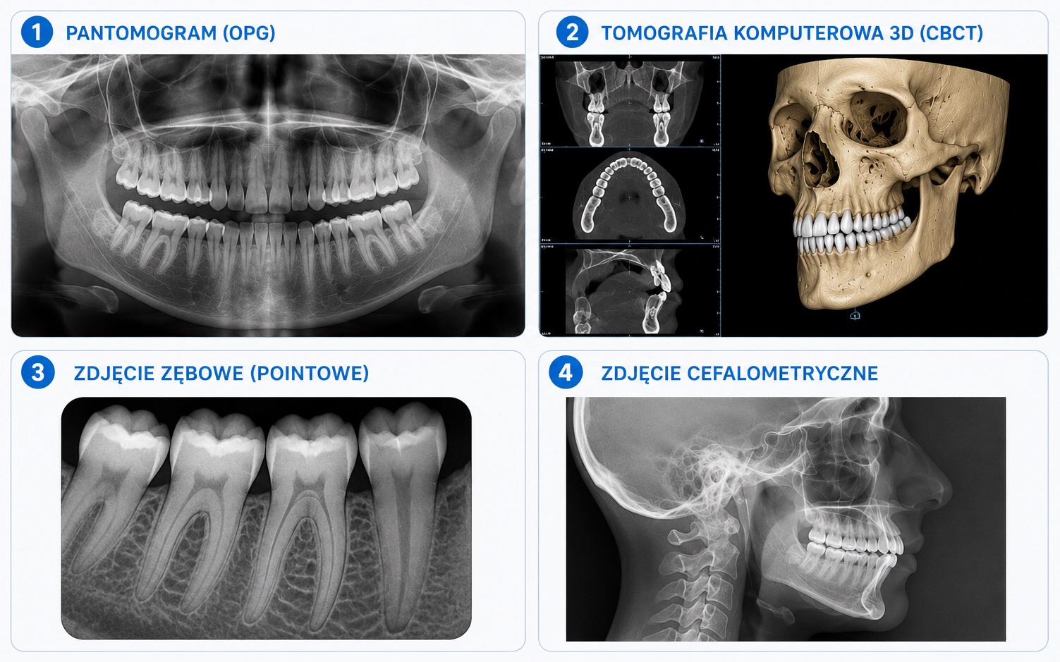 Rodzaje zdjęć RTG w ORTO-Profil: pantomogram (OPG), tomografia komputerowa 3D (CBCT), zdjęcie zębowe (pointowe) i cefalometryczne
